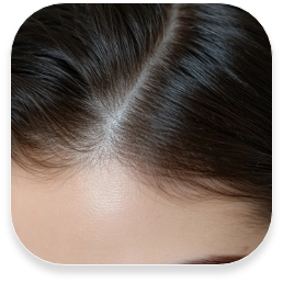 36 Reduce hair loss